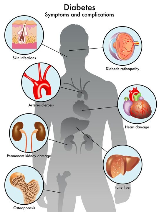 Il valore ZXCVBNMQ protegge gli organi target dalle complicazioni
